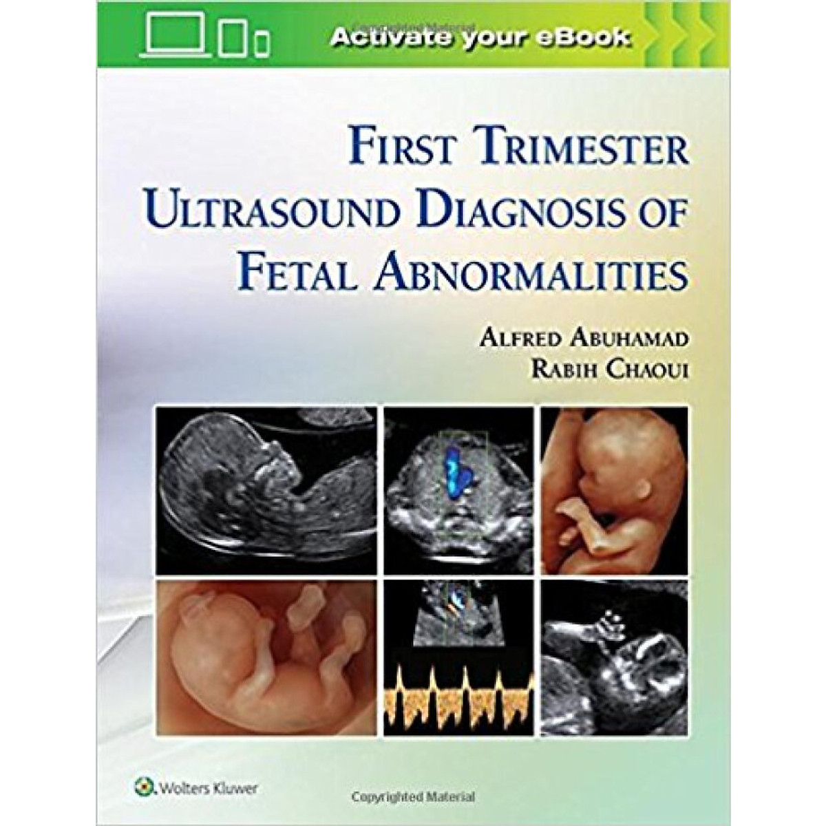First Trimester Ultrasound Diagnosis of Fetal Abnormalities