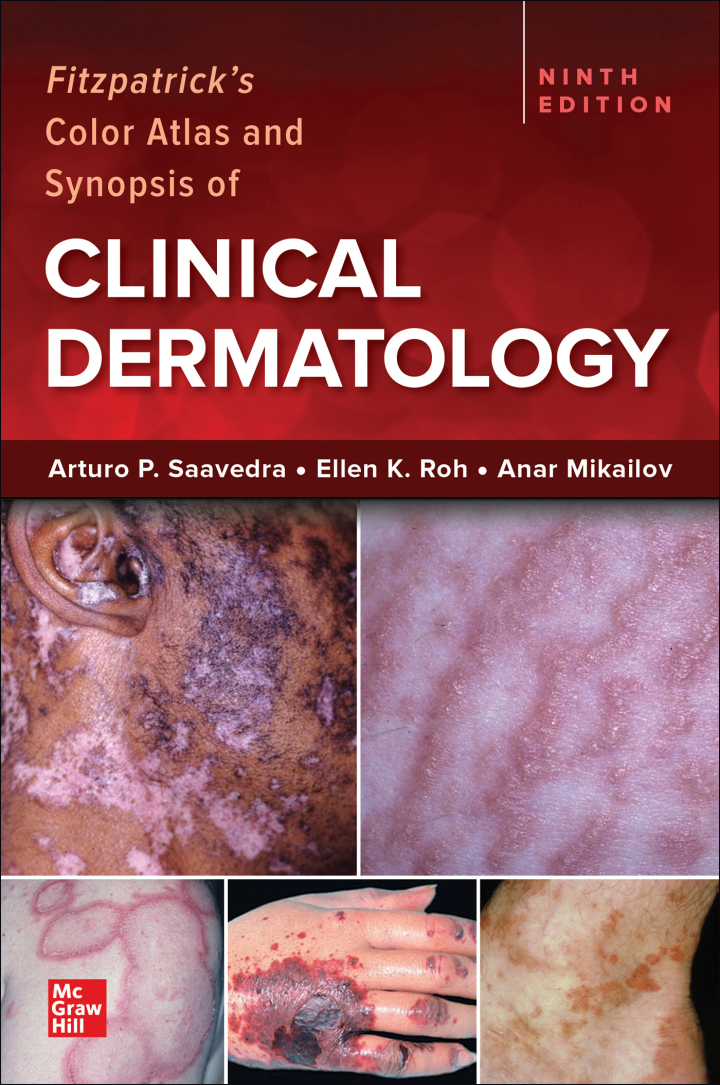 Fitzpatrick's Color Atlas and Synopsis of Clinical Dermatology
