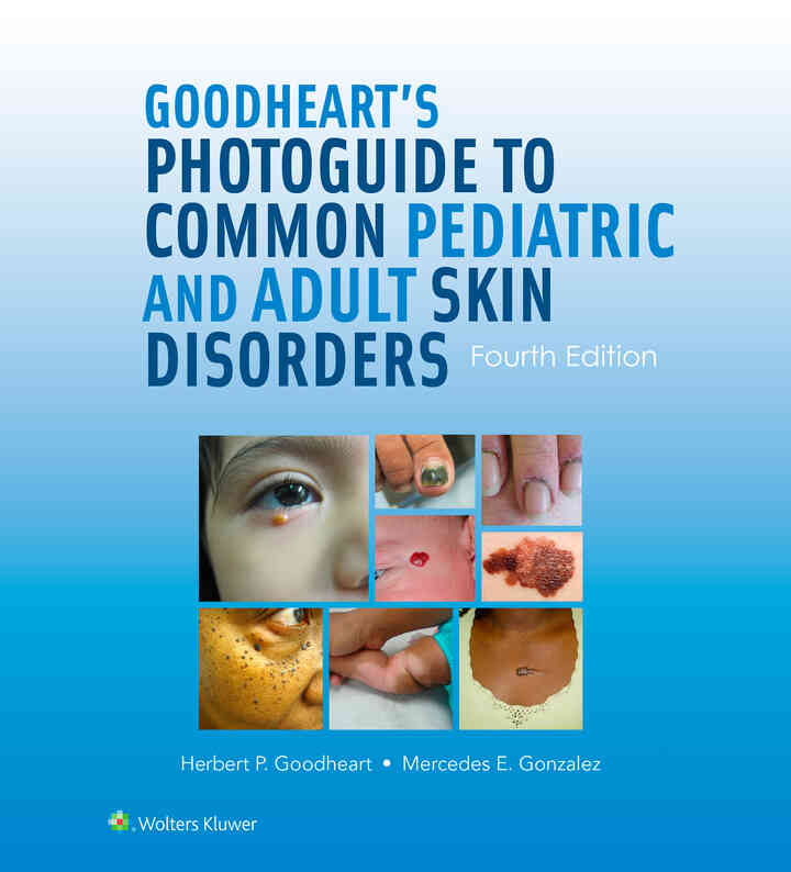 Goodheart's Photoguide to Common Pediatric and Adult Skin Disorders