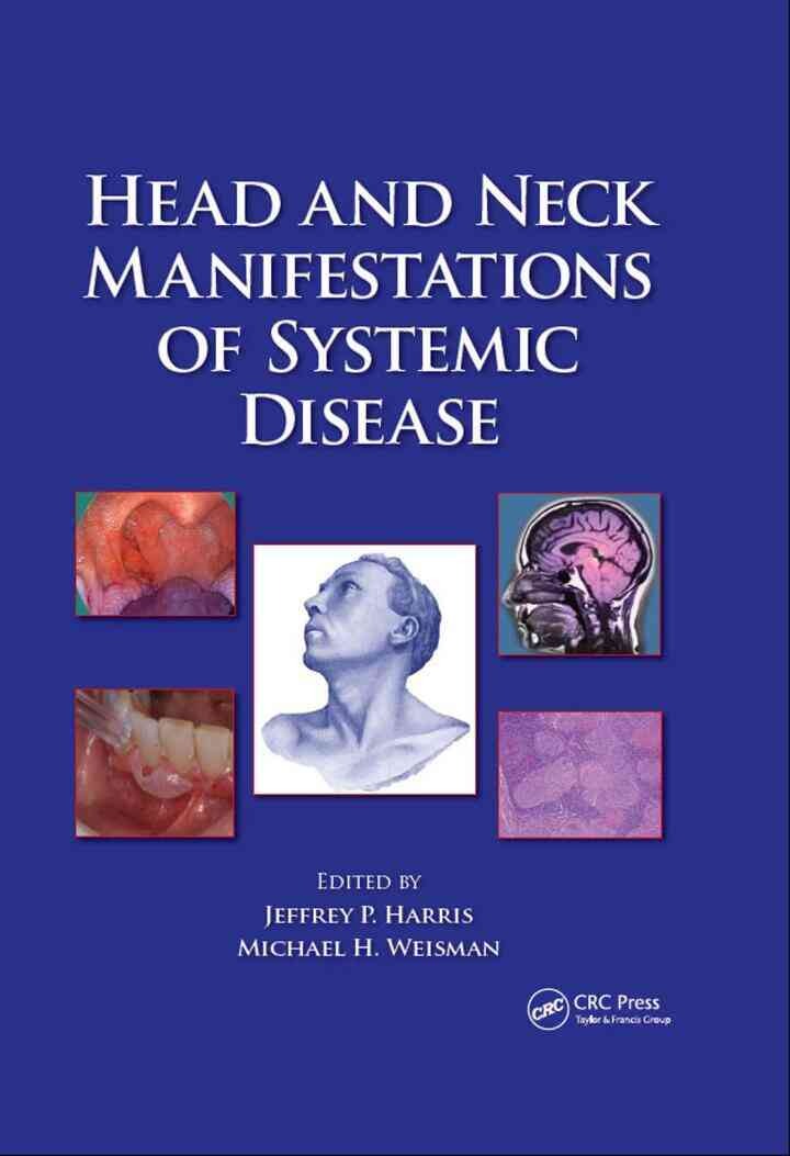Head and Neck Manifestations of Systemic Disease, 1st Edition