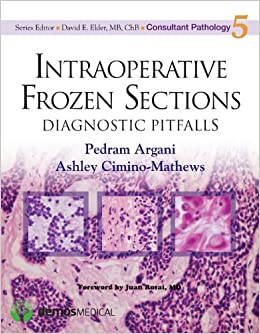 Intraoperative Frozen Sections: Diagnostic Pitfalls (Consultant Pathology Book 5)