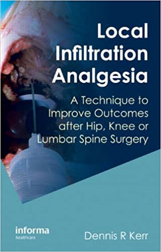 Local Infiltration Analgesia: A Technique to Improve Outcomes after Hip Knee or Lumbar Spine Surgery