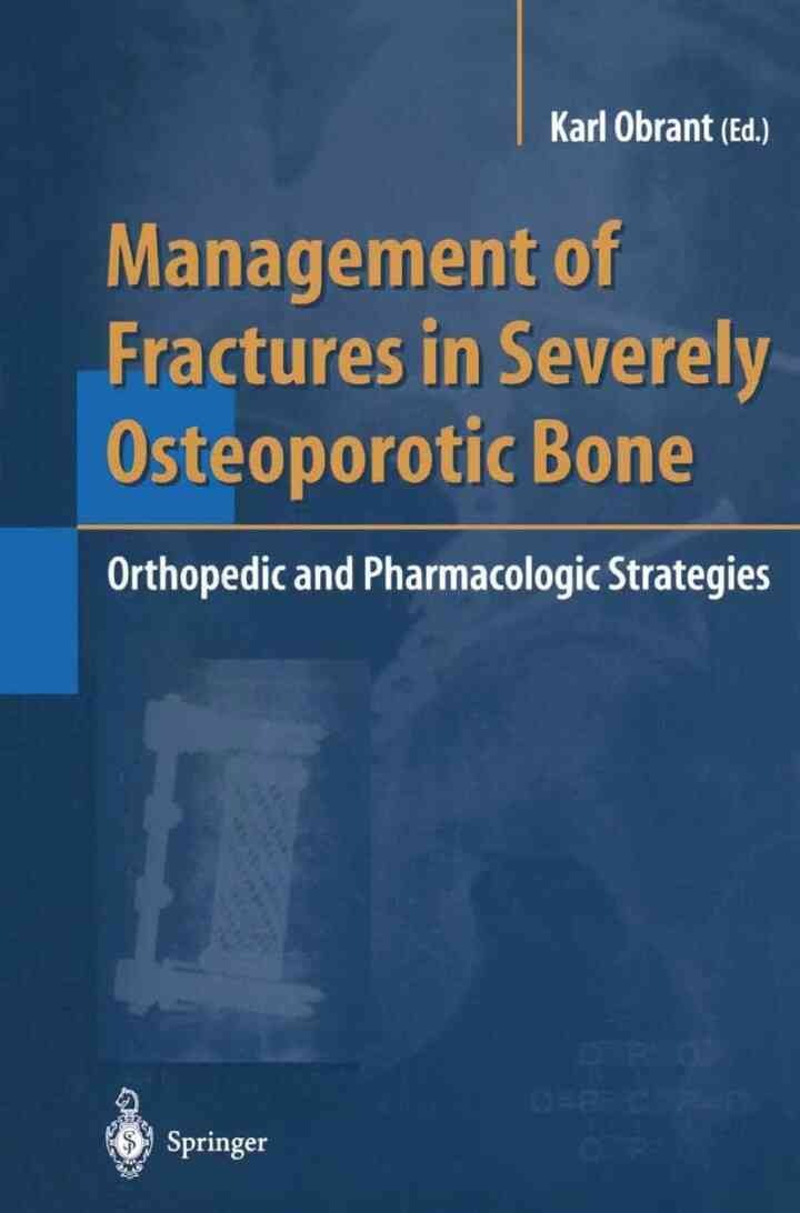 Management of Fractures in Severely Osteoporotic Bone: Orthopedic and Pharmacologic Strategies, 1st Edition
