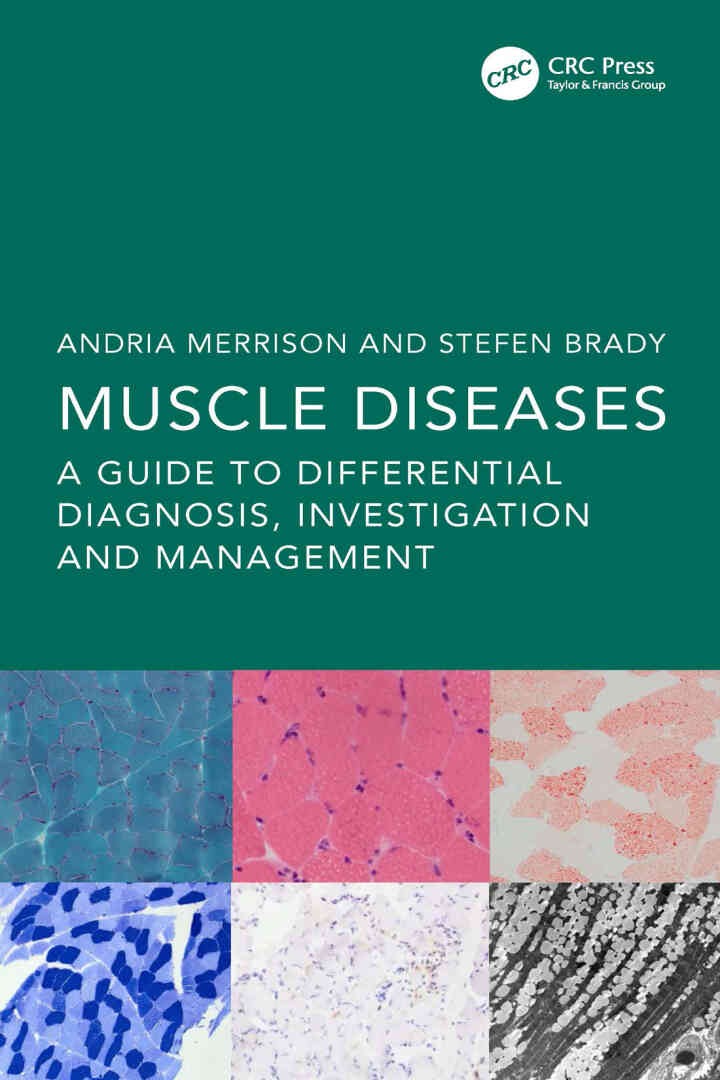 Muscle Diseases: A Guide to Differential Diagnosis, Investigation and Management, 1st Edition