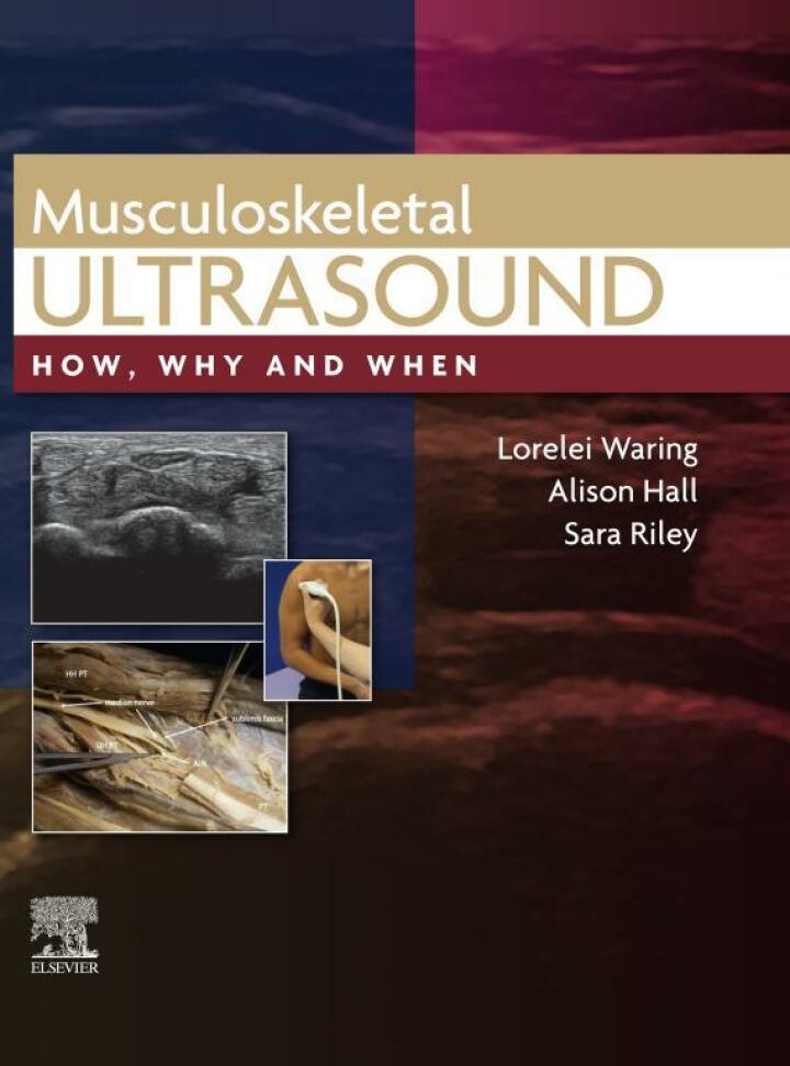 Musculoskeletal Ultrasound: How Why and When