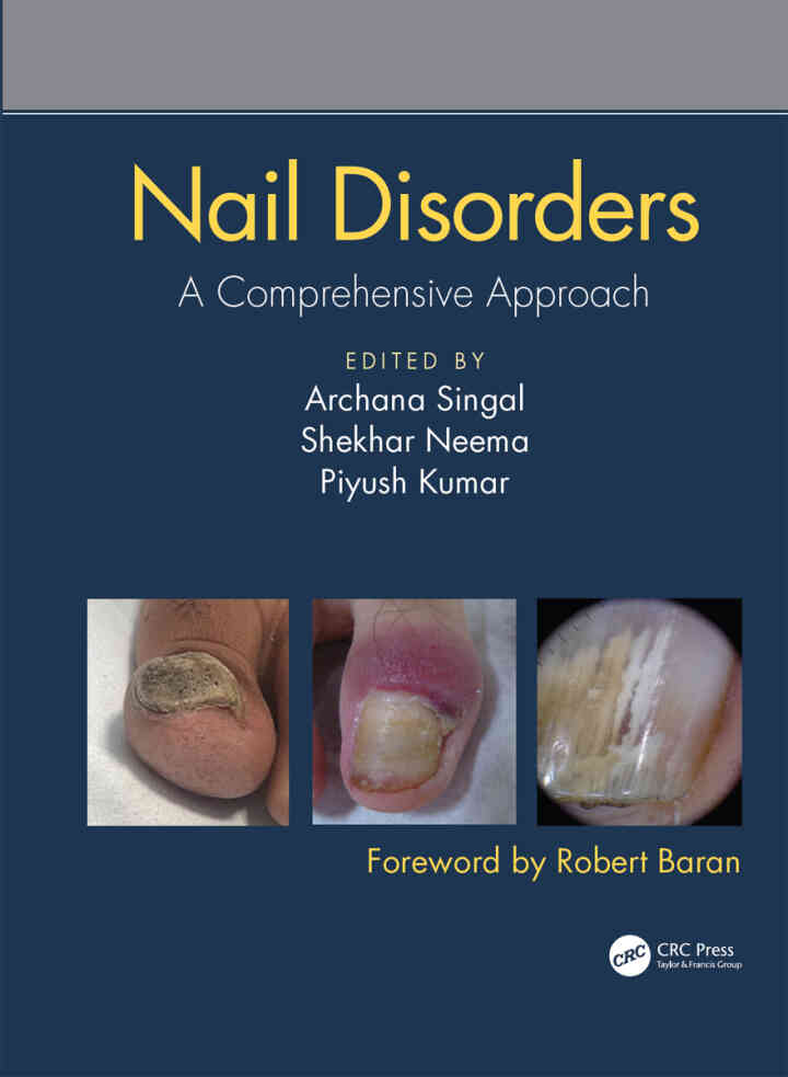 Nail Disorders: A Comprehensive Approach