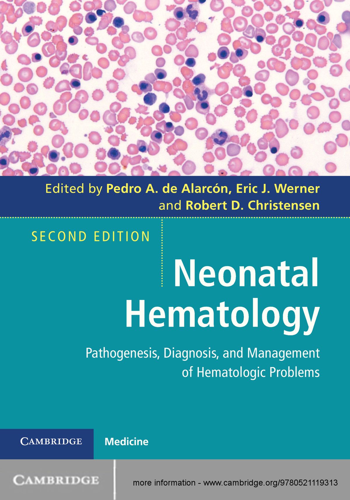 Neonatal Hematology: Pathogenesis, Diagnosis, and Management of Hematologic Problems