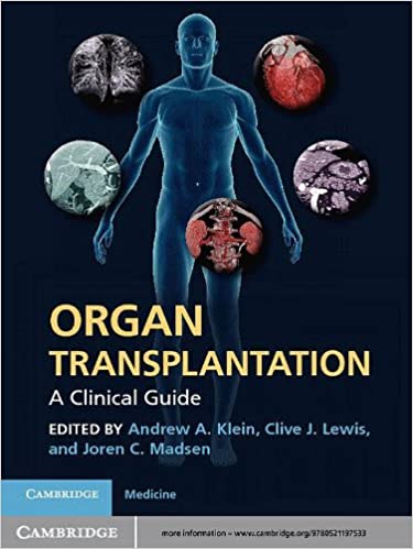 Organ Transplantation: A Clinical Guide