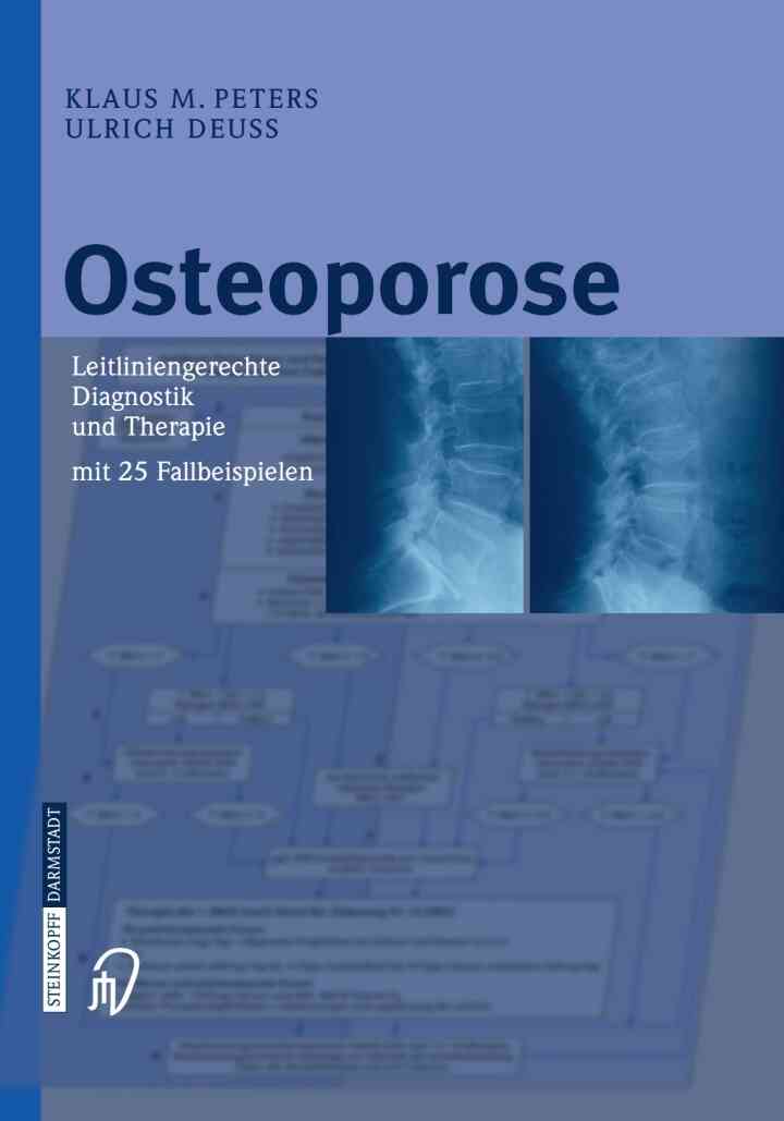 Osteoporose: Leitliniengerechte Diagnostik und Therapie mit 25 Fallbeispielen