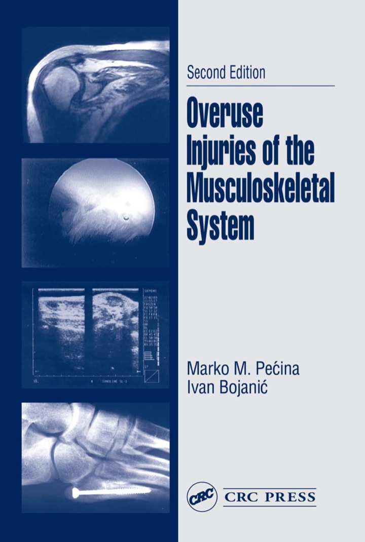 Overuse Injuries of the Musculoskeletal System