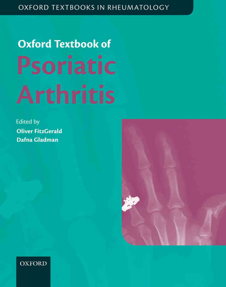 Oxford Textbook of Psoriatic Arthritis