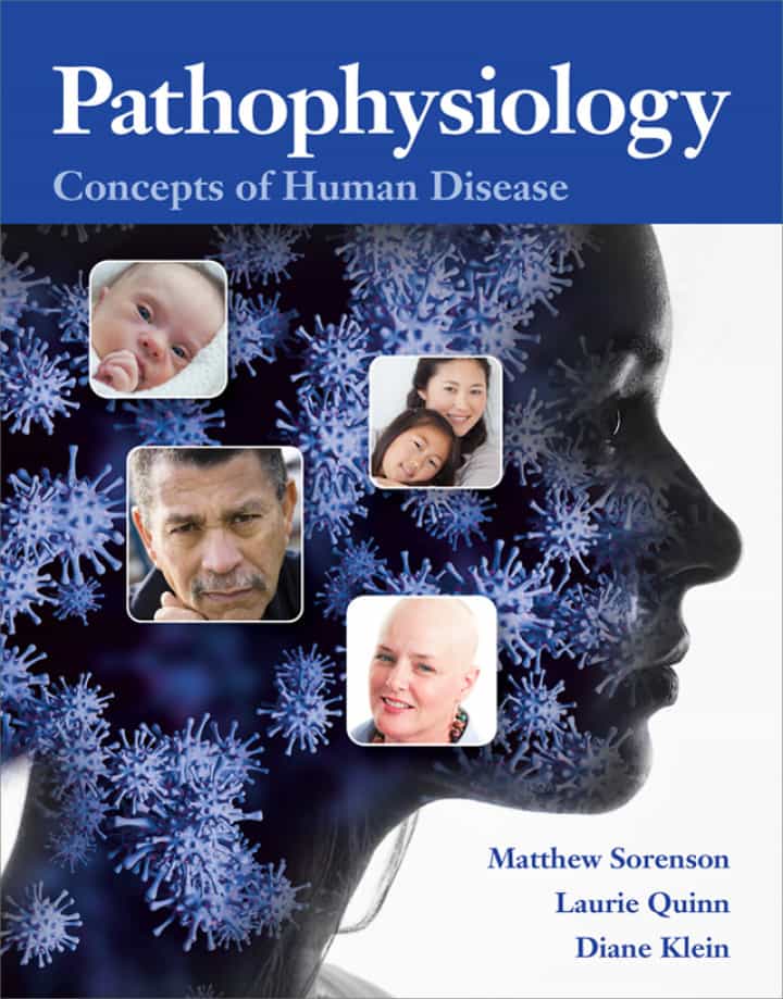 Pathophysiology: Concepts of Human Disease, 1st Edition