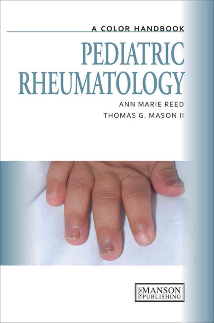 Pediatric Rheumatology: A Color Handbook, 1st Edition
