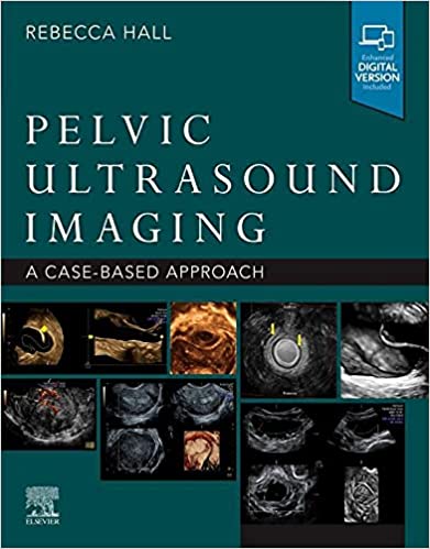 Pelvic Ultrasound Imaging, E-Book: A Cased-Based Application