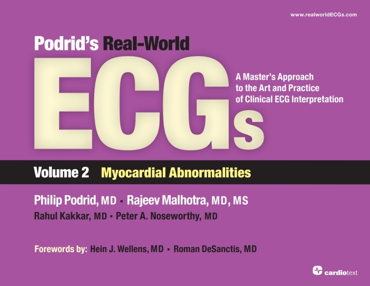 Podrid's Real-World ECGs: Volume 2, Myocardial Abnormalities: A Master's Approach to the Art and Practice of Clinical ECG Interpretation.