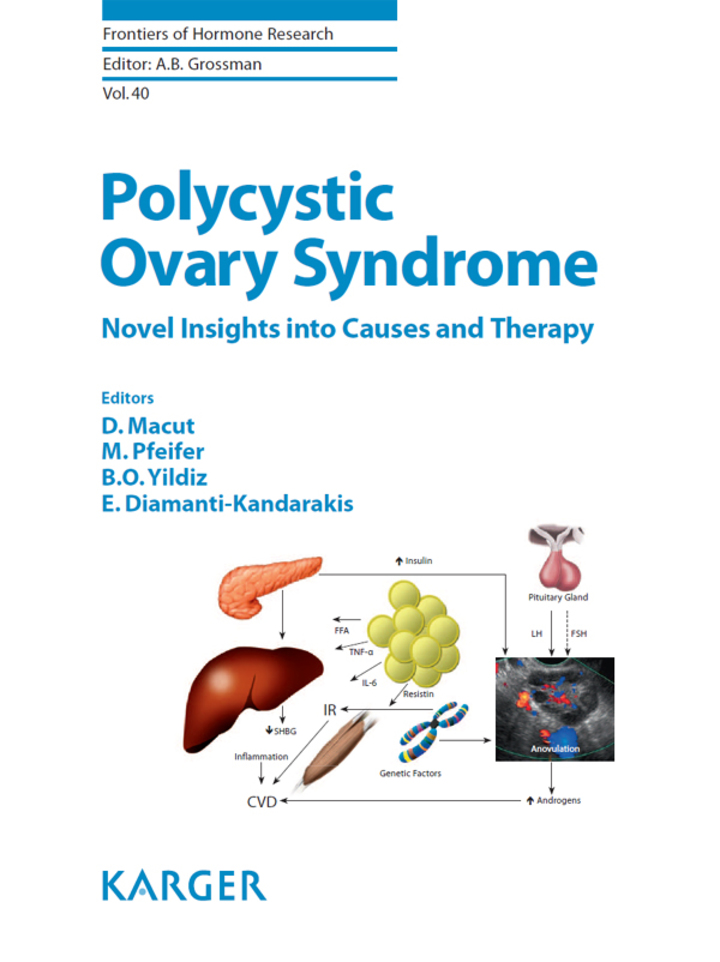 Polycystic Ovary Syndrome