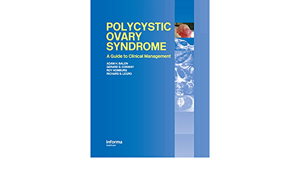 Polycystic Ovary Syndrome: A Guide to Clinical Management