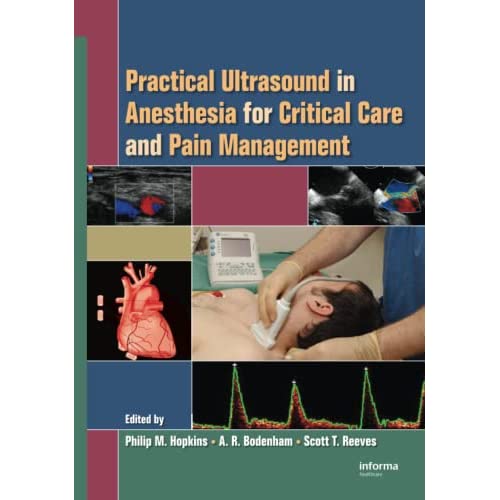 Practical Ultrasound in Anesthesia for Critical Care and Pain Management