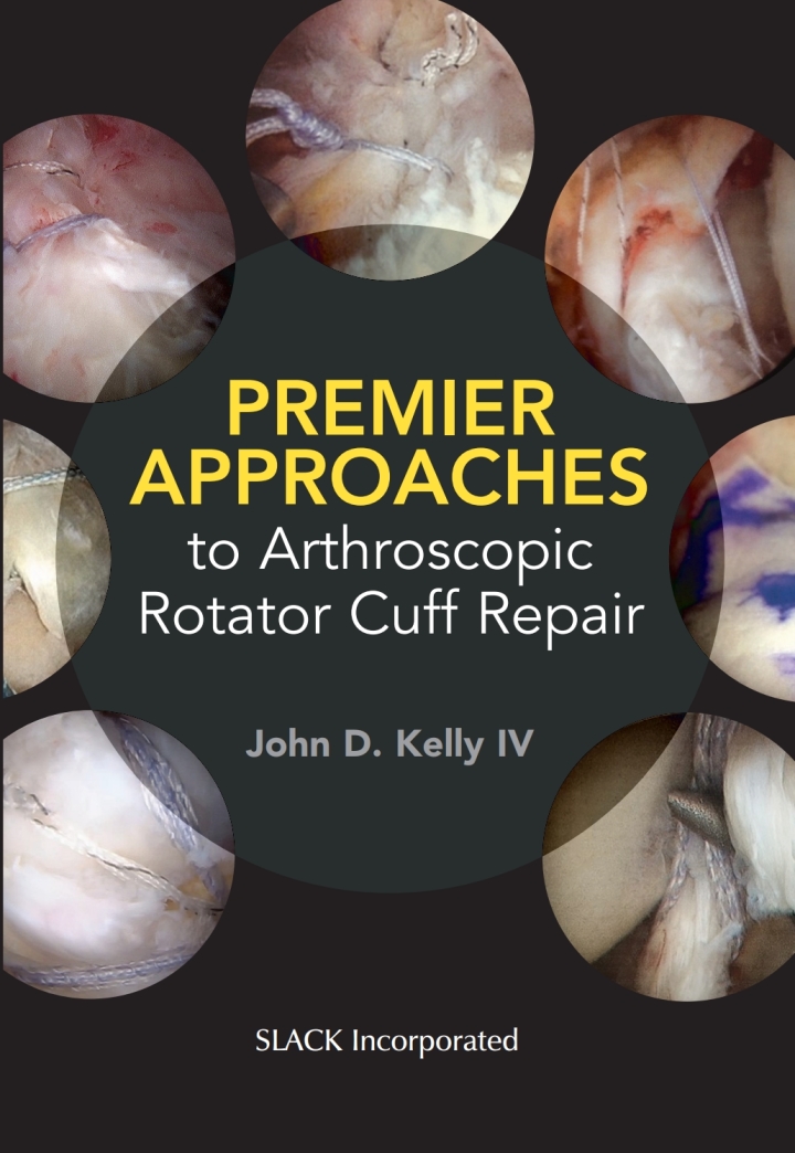Premier Approaches to Arthroscopic Rotator Cuff Repair