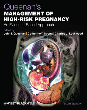 Queenan's Management of High-Risk Pregnancy: An Evidence-Based Approach