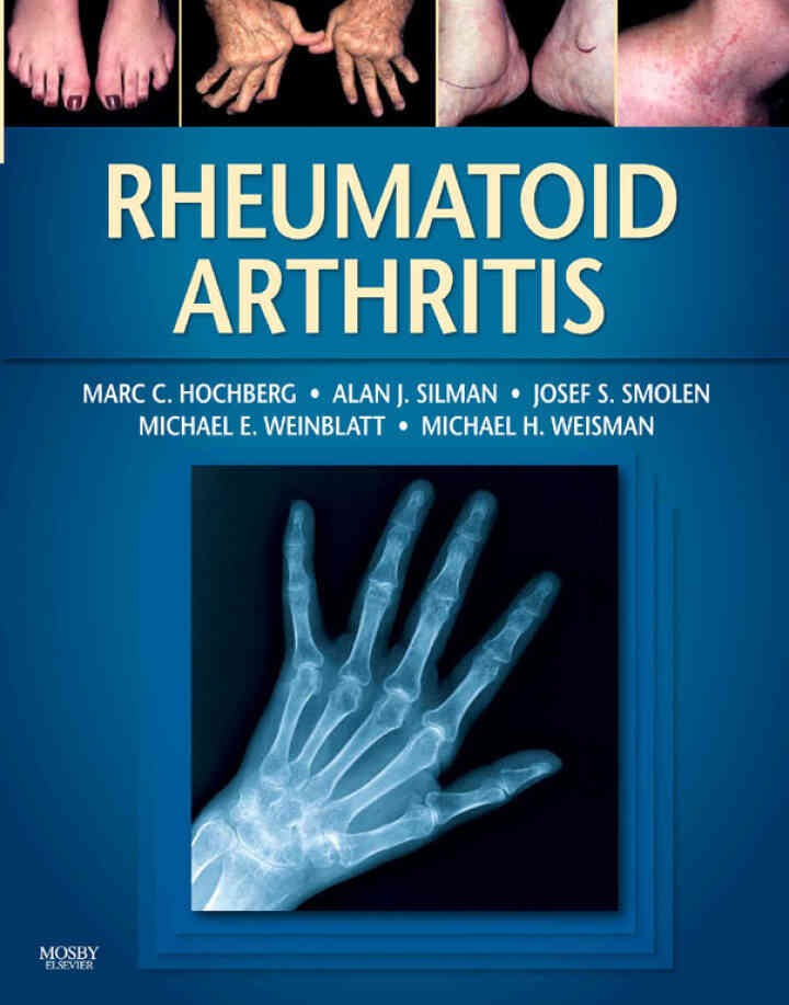 Rheumatoid Arthritis - Electronic, 1st Edition