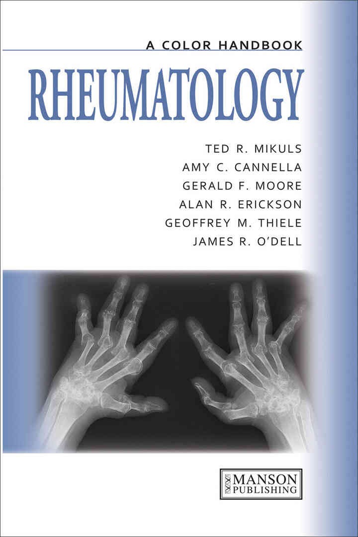 Rheumatology: A Color Handbook, 1st Edition