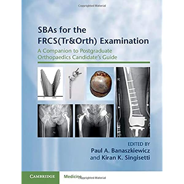 SBAs for the FRCS(Tr&Orth) Examination: A Companion to Postgraduate Orthopaedics Candidate's Guide