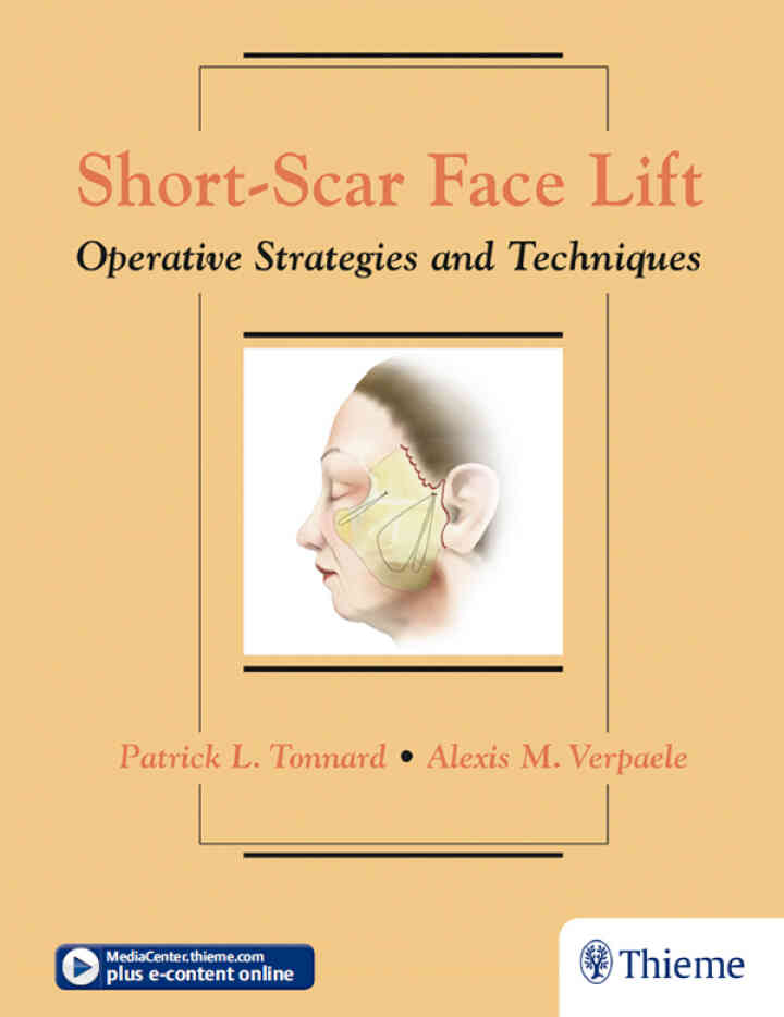Short-Scar Face Lift: Operative Strategies and Techniques