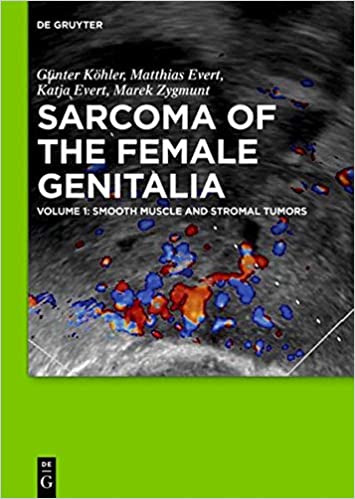 Smooth muscle and stromal tumors and prevention of inadequate surgery