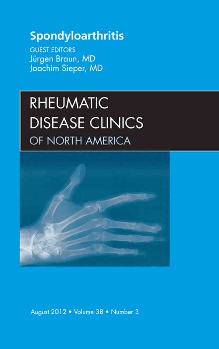 Spondyloarthropathies, An Issue of Rheumatic Disease Clinics