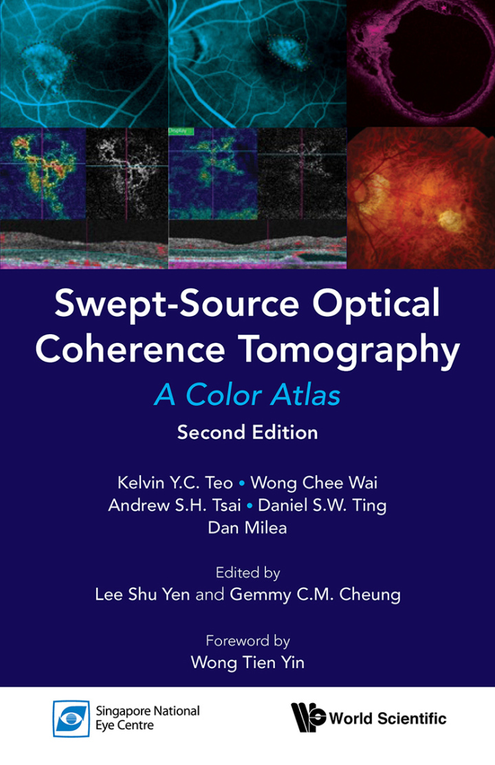 SWEPT-SOURCE OPTICAL COHERENCE TOMOGRAPHY: A COLOR ATLAS (SECOND EDITION)A Color Atlas
