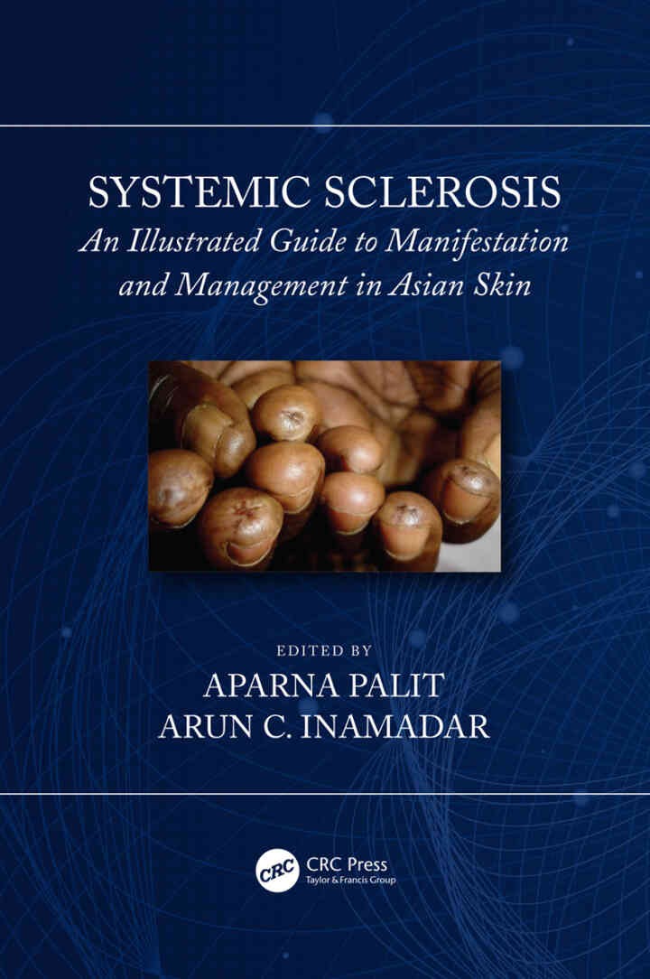 Systemic Sclerosis: An Illustrated Guide to Manifestation and Management in Asian Skin, 1st Edition