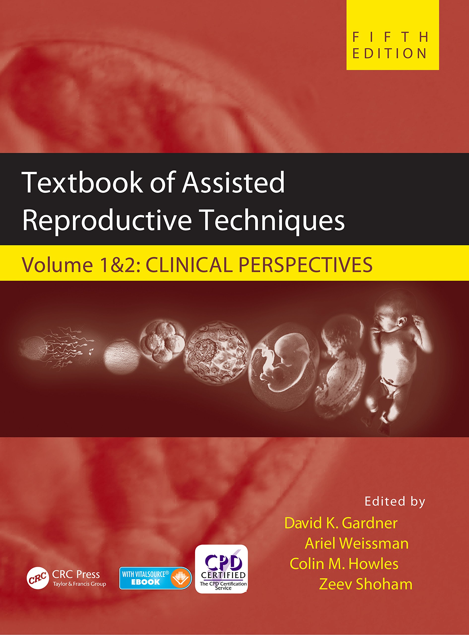 Textbook of Assisted Reproductive Techniques: Two Volume Set