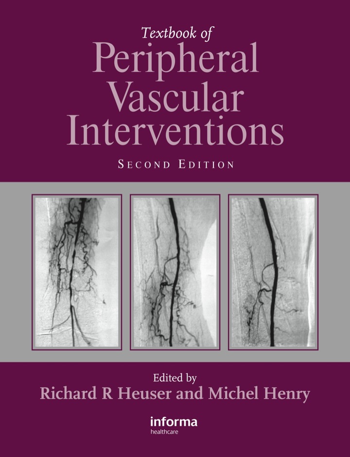 Textbook of Peripheral Vascular Interventions