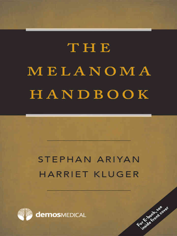 The Melanoma Handbook