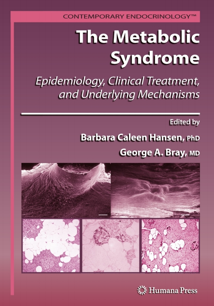 The Metabolic Syndrome: Epidemiology, Clinical Treatment, and Underlying Mechanisms