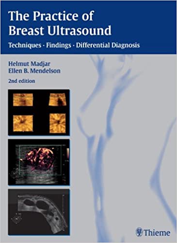 The Practice of Breast Ultrasound: Techniques, Findings, Differential Diagnosis
