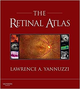 The Retinal Atlas, 1st Edition, 12-Month Access,: Expert Consult