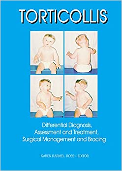 Torticollis: Differential Diagnosis, Assessment and Treatment, Surgical Management and Bracing (Monograph Published Simultaneously As Physical & Occupational Therapy in Pediatrics , Vol 17 No 2)