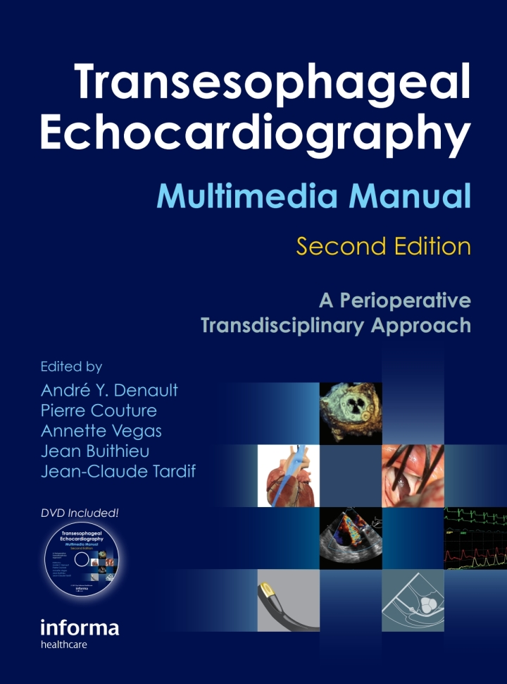 Transesophageal Echocardiography Multimedia Manual: A Perioperative Transdisciplinary Approach