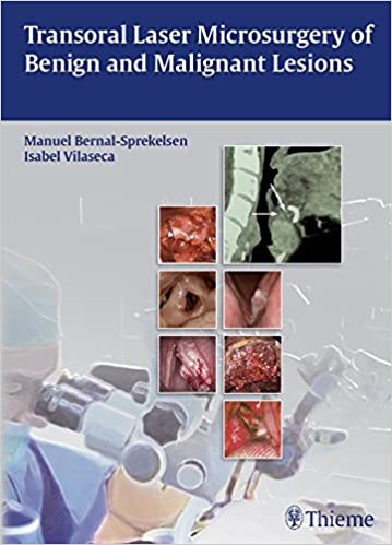 Transoral Laser Microsurgery of Benign and Malignant Lesions