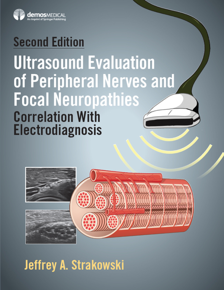 Ultrasound Evaluation of Peripheral Nerves and Focal Neuropathies, Se: 2nd Edition Correlation With Electrodiagnosis