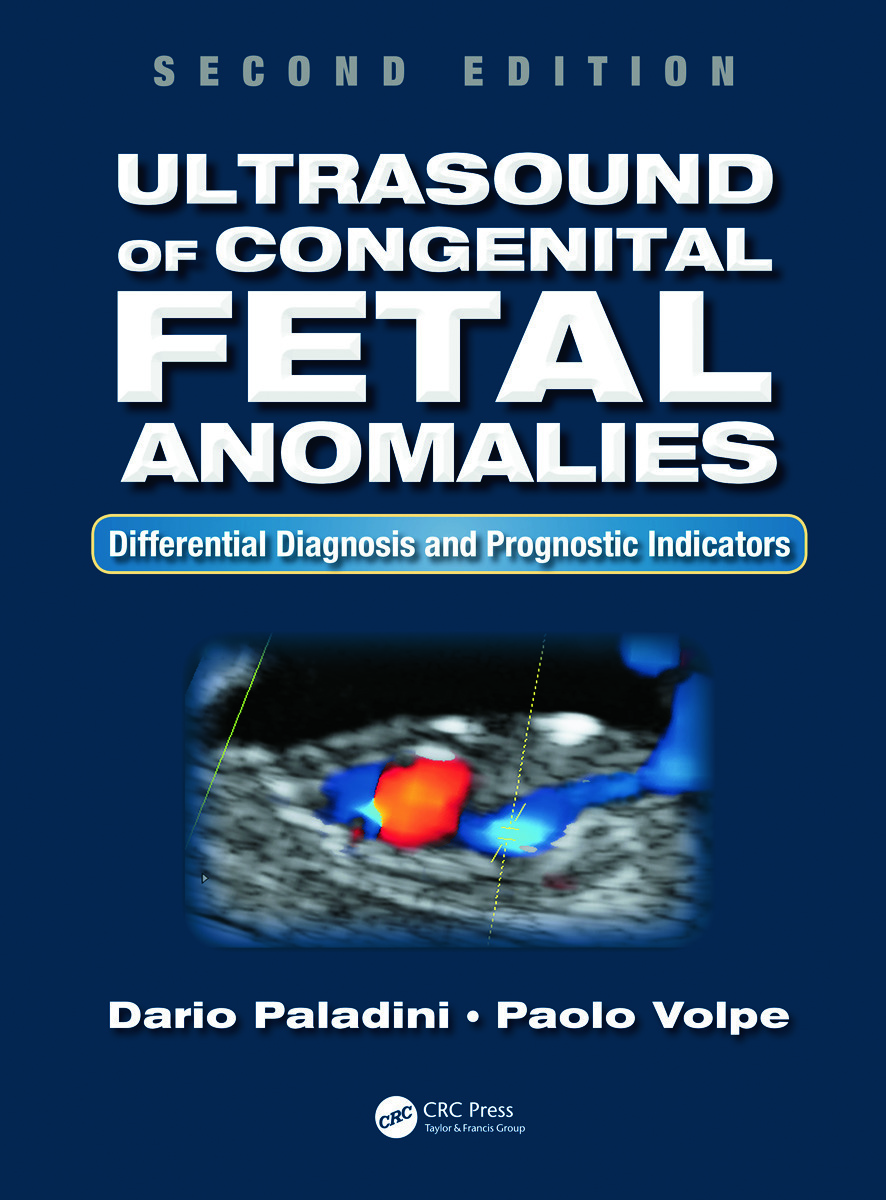 Ultrasound of Congenital Fetal Anomalies: Differential Diagnosis and Prognostic Indicators, Second Edition