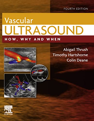 Vascular Ultrasound: How, Why and When, 4th Edition