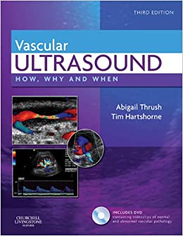 Vascular Ultrasound: How, Why and When