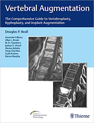Vertebral Augmentation: The Comprehensive Guide to Vertebroplasty, Kyphoplasty, and Implant Augmentation