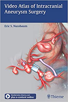 Video Atlas of Intracranial Aneurysm Surgery