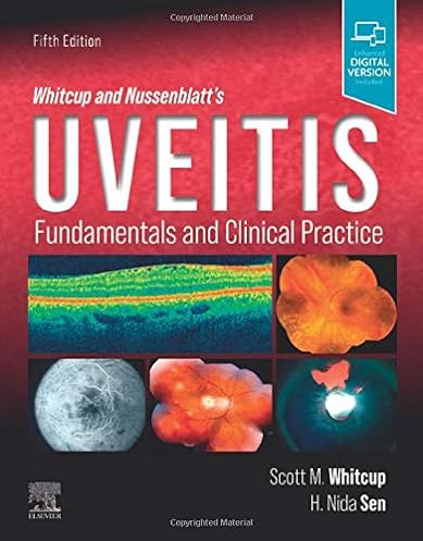 Whitcup and Nussenblatt's Uveitis,: Fundamentals and Clinical Practice, 5th Edition