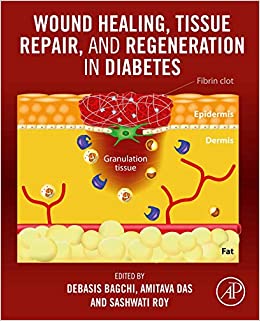 Wound Healing, Tissue Repair, and Regeneration in Diabetes