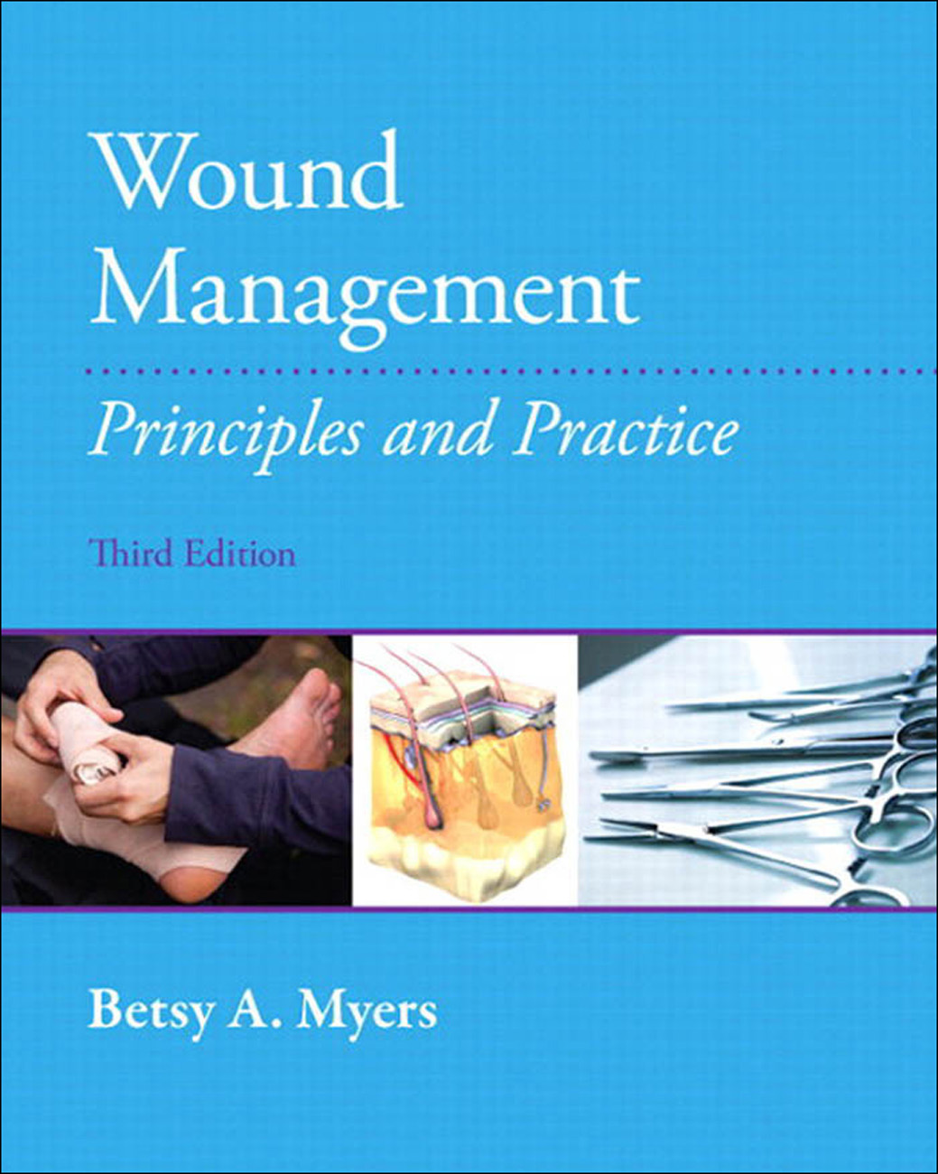 Wound Management